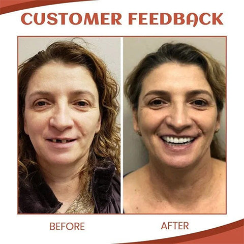 Prothesen Anpassungs-Set | Flexibles Silikon | Sicherer Sitz & Komfort | Für Ober- & Unterkiefer