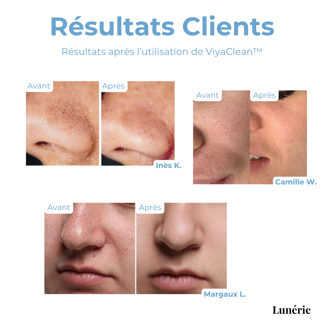 FrischPoren™ Hauterneuerungstherapie