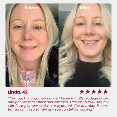 GlanzMaske™ Jugendliche Haut Maske